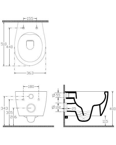 Унитаз Allen Brau Fantasy 4.11004.SM подвесной Розовый без сиденья