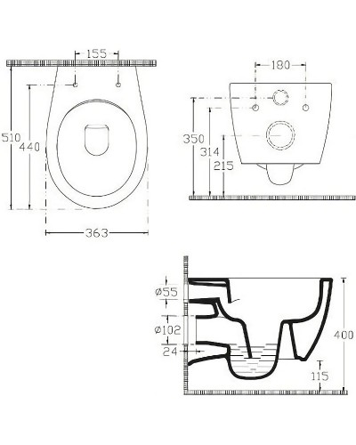 Унитаз биде Allen Brau Fantasy 4.11HC1.20 подвесной Белый без сиденья